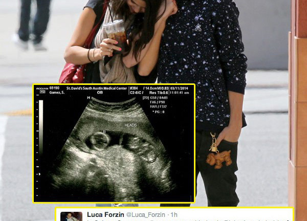 Selena Gomez và những tin đồn trớ trêu