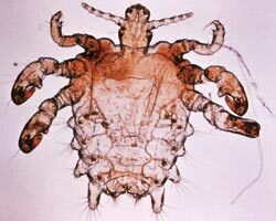 Rận mu: Cận cảnh loài ký sinh vùng kín đe dọa