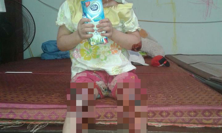 Làm đơn kêu cứu, xin đưa Bé Tâm Anh chùa Bồ Đề đi chữa bệnh