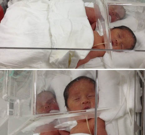 Hi hữu ca sinh tư ở Hà Nội: Hành trình vượt cạn của sản phụ trẻ