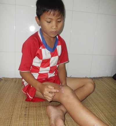 Bé 12 tuổi bị bắt cóc, đánh suýt chết vì bị nghi... trộm gà