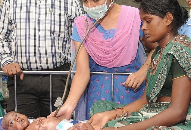 Ấn Độ: Ngọn lửa bí ẩn và cậu bé 2 tháng 4 lần tự bốc cháy