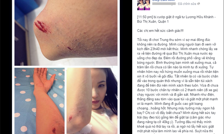 Diệp Lâm Anh giở võ hạ đo ván hai tên cướp giật đồ