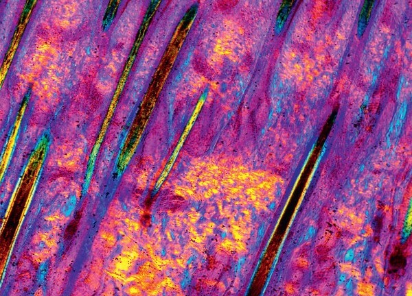 Cận cảnh cơ thể người tuyệt đẹp qua lăng kính hiển vi