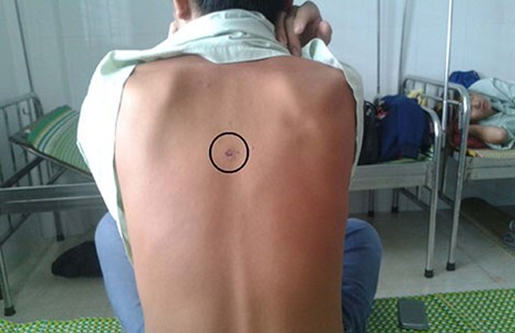 Trưởng công an xã bị đình chỉ vì hành hạ trẻ vị thành niên