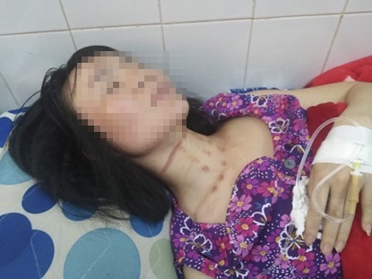 Chủ quán cà phê kể lại giây phút kinh hoàng bị kẻ cướp siết cổ