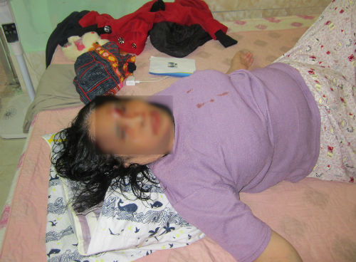 Sự thật vụ con dâu hành hung mẹ chồng ở Hà Nội