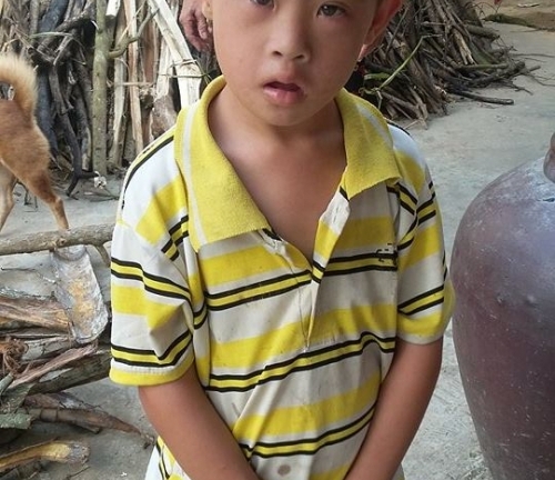 Vành khăn trắng trên đầu người đàn bà khốn khổ nuôi hai con bị down