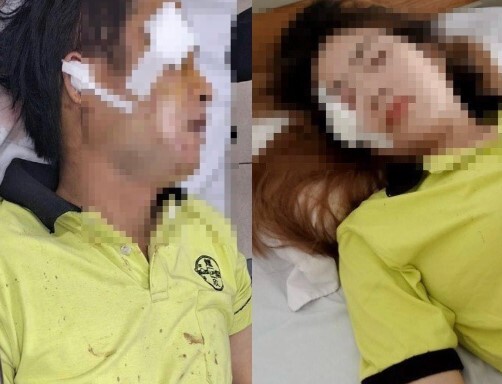 Bị chó dữ đuổi cắn, 2 vợ chồng ngã xe trọng thương