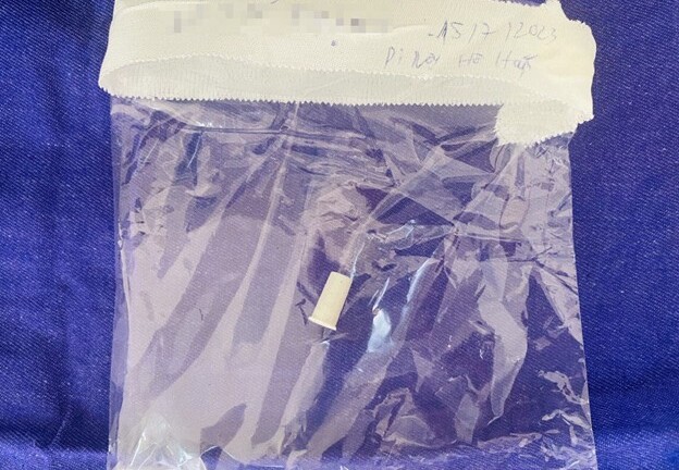 Phát hiện dị vật lạ trong cổ họng của bệnh nhi 6 tuổi