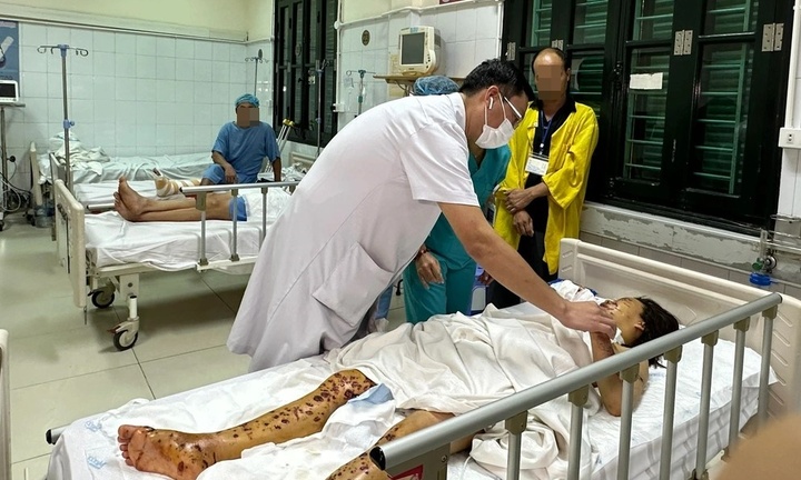 Điện thoại đang sạc phát nổ khiến người phụ nữ bị vỡ nhãn cầu, chi chít hàng trăm vết thương