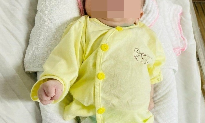 Cứu sống trẻ sơ sinh bị uốn ván rốn nguy hiểm do sinh tại nhà