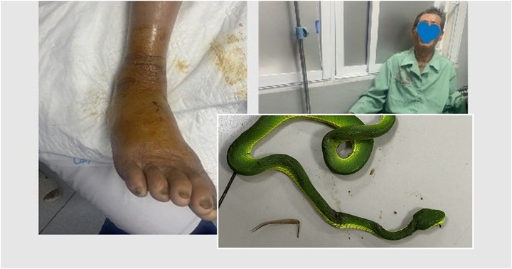 Truyền 10 lọ huyết thanh cứu người đàn ông bị rắn lục đuôi đỏ cắn