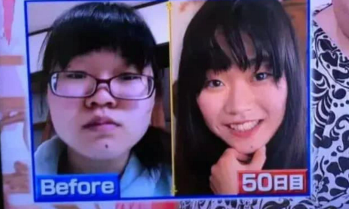 Chẳng cần phẫn thuật thẩm mỹ, cô gái có màn 