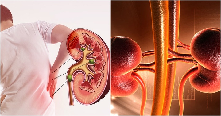 Vì sao suy thận ngày càng trẻ hóa? Những dấu hiệu nhận biết suy thận và cách phòng ngừa