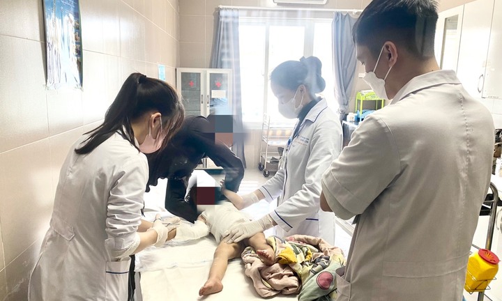 Hai bệnh nhi bị bỏng nặng do nước sôi, bác sĩ cảnh báo gì?