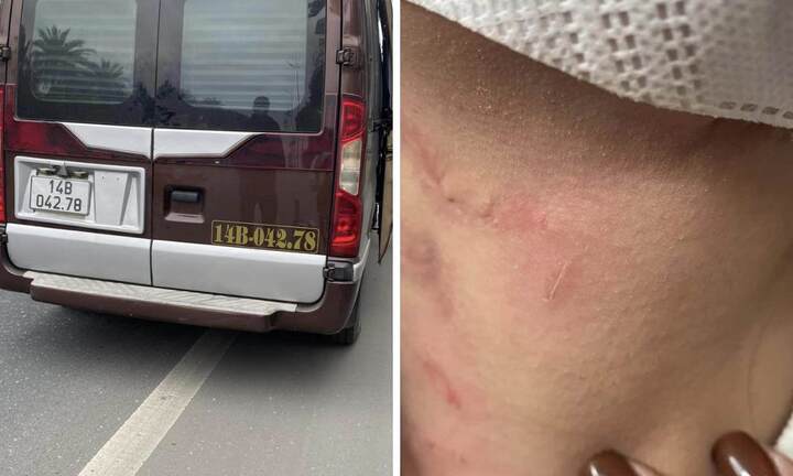 Vụ nữ hành khách bị nhà xe hành hung, bỏ rơi giữa cao tốc: Xử phạt chủ xe limousine 