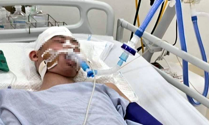 Vụ nam sinh lớp 9 bị đánh chấn thương sọ não: Nghẹn lòng lời kể của người mẹ