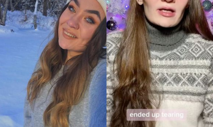 Thiếu nữ rụng hết răng vì tác dụng phụ của thuốc giảm đau