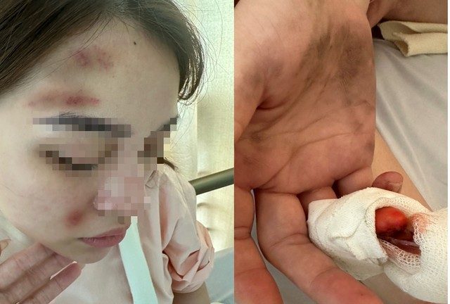 Xác minh thông tin cảnh sát hình sự ở Hải Phòng bị tố hành hung bạn gái