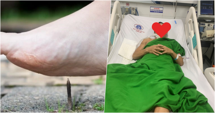 Phú Thọ: Chủ quan với chiếc đinh gỉ, người đàn ông nguy kịch