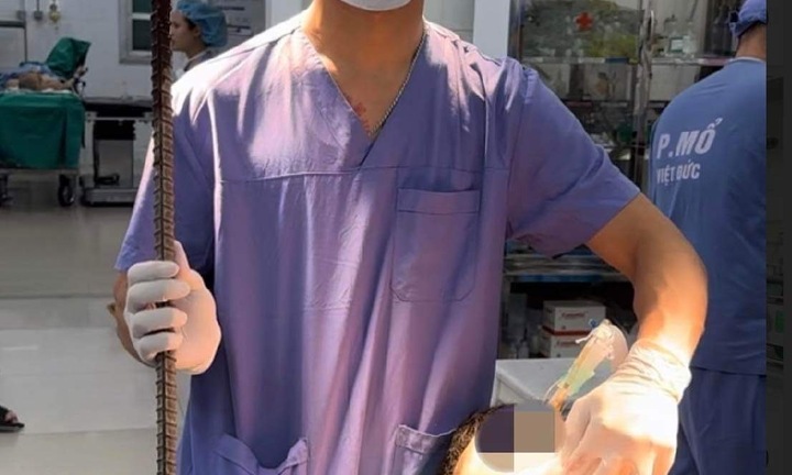 Hà Nội: Cấp cứu thành công người đàn ông bị xà beng dài 90cm đâm xuyên cổ