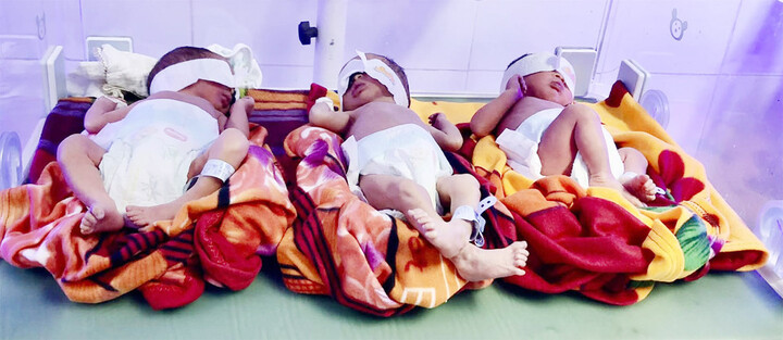 Nghệ An: Sau 8 năm hiếm muộn, sản phụ sinh 3 cùng trứng hiếm gặp 