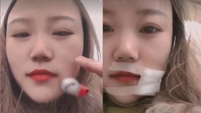 Người vợ bị chồng quăng móc câu trúng má khi đang đi câu cá với nhau