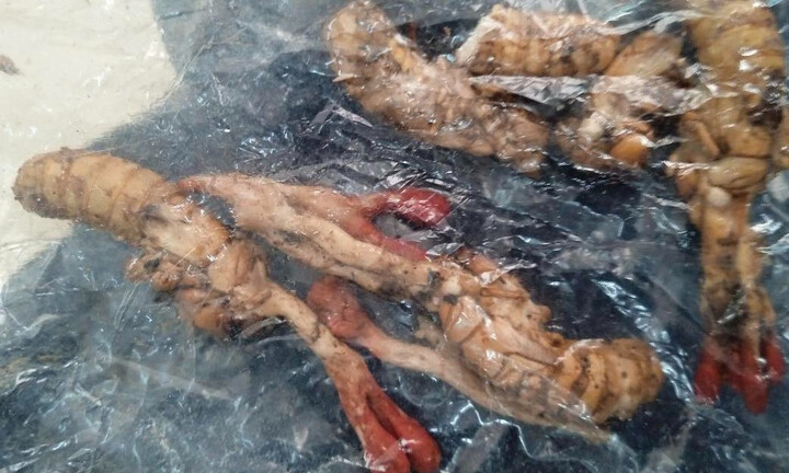 Cứu sống bệnh nhân suýt chết do ăn nhộng ve sầu