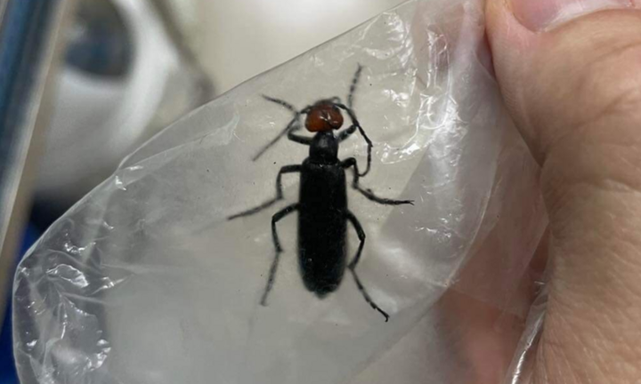 Lạng Sơn: 3 người nôn ra máu, nhập viện nguy kịch sau khi ăn phải sâu ban miêu