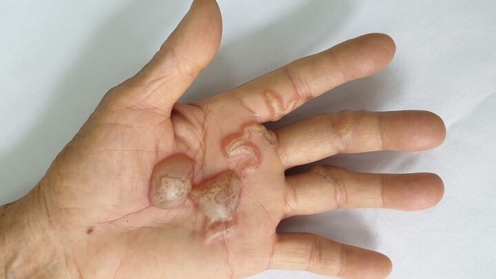 Cảnh báo nhiễm ký sinh trùng từ động vật nuôi trong nhà