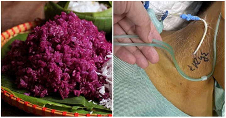 Gia đình 4 người ngộ độc sau khi ăn xôi màu từ cây cỏ, bác sĩ khuyến cáo gì?