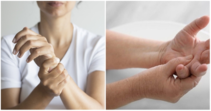 Cảnh báo những bệnh thường gặp nếu bỗng nhiên tay bị tê