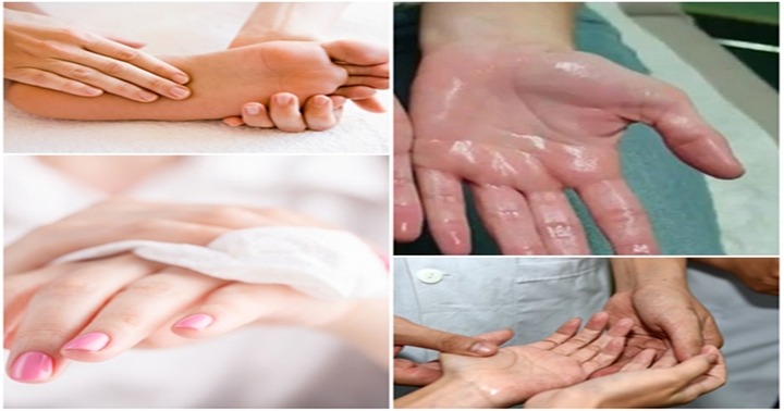 Nguyên nhân và cách khắc phục mồ hôi tay, mồ hôi chân hiệu quả