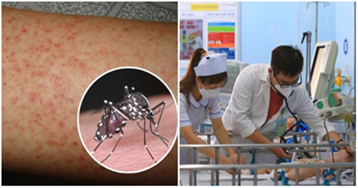 Hà Nội phát hiện thêm 59 ổ dịch sốt xuất huyết, nguy cơ bùng phát dịch bệnh