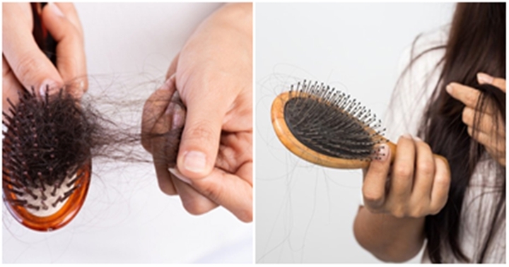 Nếu rụng tóc trên 100 sợi/ngày rất có thể bạn đang gặp vấn đề bất thường do bệnh lý