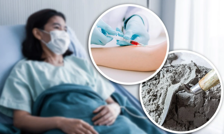 Bác sĩ  "dỏm " bắt bệnh nhân bôi xi măng trộn vôi để điều trị ung thư