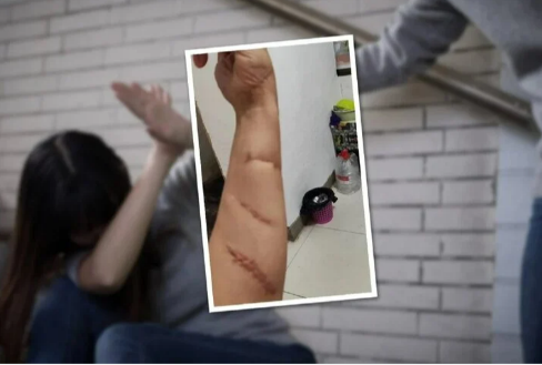 Sẵn sàng lấy thân đỡ 20 nhát chém cứu bạn, cô gái không ngờ bạn lại là người “vong ân bội nghĩa”