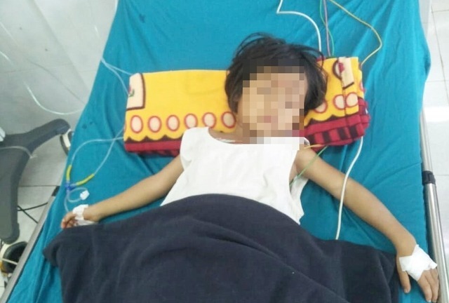 Vụ 3 anh em ngộ độc do ăn thịt và trứng cóc: 2 trẻ tử vong, 1 em đang cấp cứu