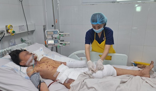 Nam sinh 11 tuổi bị thương nặng do chơi pháo