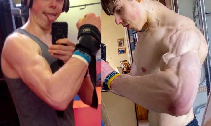 Ngôi sao nổi tiếng qua đời ở tuổi 27 do giảm cân quá mức và chế độ ăn uống sai lầm