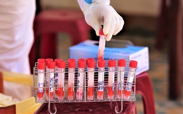 Tối 16/5: Việt Nam ghi nhận 54 ca mắc COVID-19 trong nước, riêng Bắc Ninh có 24 ca