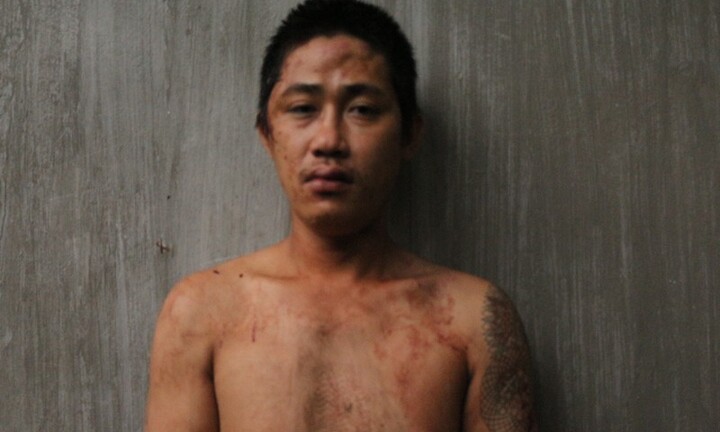 TP.HCM: Nam thanh niên say xỉn, dùng mảnh kính tấn công công an TP.Thủ Đức