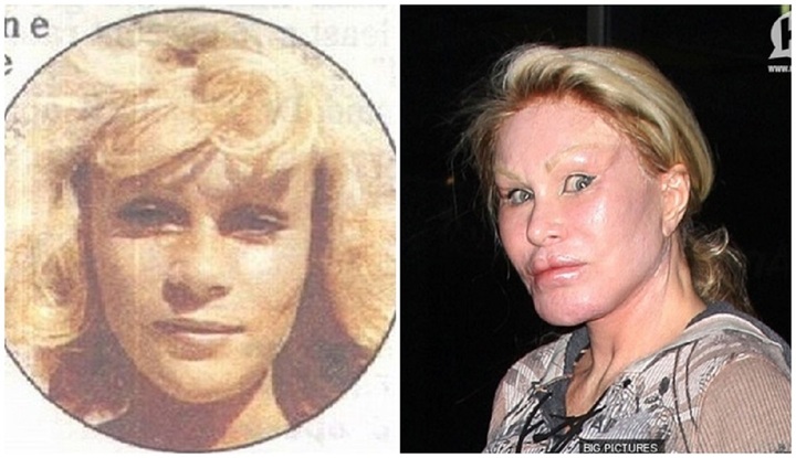 Những ca phẫu thuật thẩm mỹ thất bại của showbiz: Từ nổi tiếng đến biểu tượng