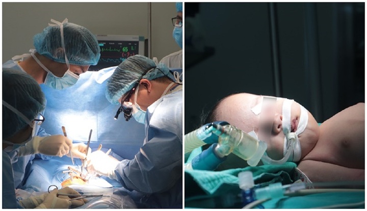 Nghẹt thở quá trình đặt máy tạo nhịp cho bé 40 ngày tuổi bị tim bẩm sinh phức tạp