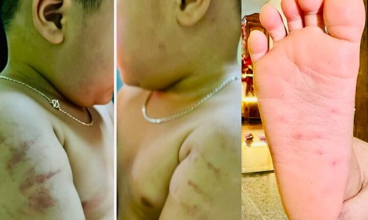 Vụ bé gái 4 tuổi nghi bị bạo hành ở Bình Định: Người thân hé lộ tình trạng sức khỏe