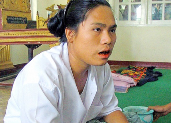 Cơ thể mọc thêm “vật lạ” chỉ sau một đêm, cô gái bỗng biến thành đàn ông trong sự ngỡ ngàng 