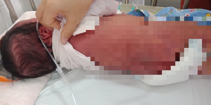 Tin tức đời sống ngày 25/5: Bé sơ sinh nguy kịch vì tắm lá chữa vàng da