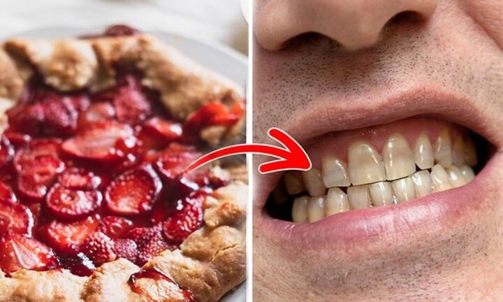 7 thói quen cần bỏ ngay nếu không muốn răng ố vàng, xỉn màu gây mất thẩm mỹ