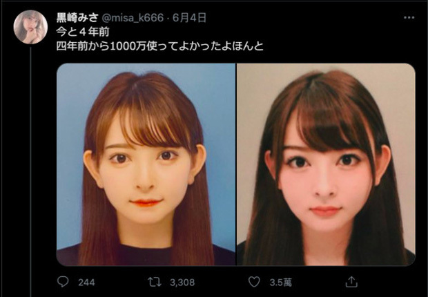 Mẫu nữ xinh đẹp chi hơn 2 tỷ đồng phẫu thuật thẩm mỹ, thành quả sau 4 năm “gây choáng”